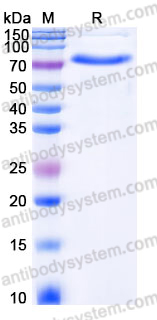 Recombinant Human XPNPEP1 Protein, C-His