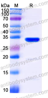 Recombinant Human CA10 Protein, C-His