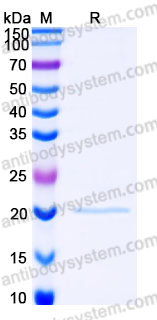 Recombinant Human NIP7 Protein, N-His