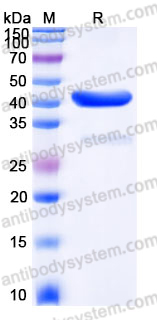 Recombinant Human UBE2D4 Protein, N-GST