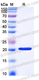 Recombinant Human PPIL1 Protein, N-His