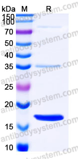 Recombinant Human LSM4 Protein, N-His