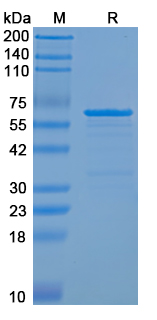 Recombinant Human SERPINI1 Protein, N-GST