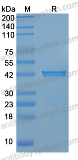 Recombinant Human SERPINI1 Protein, N-His