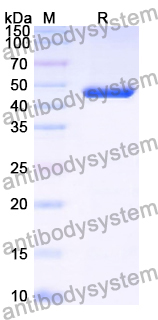 Recombinant Mouse MASP2 Protein, N-His
