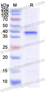 Recombinant Mouse WNT10B Protein, N-His