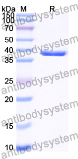 Recombinant Mouse NDUFAB1 Protein, N-GST & C-His