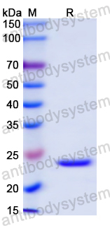 Recombinant Mouse AIM2 Protein, N-His