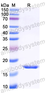 Recombinant Mouse LECT2 Protein, N-His