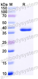 Recombinant Mouse OGG1 Protein, N-His