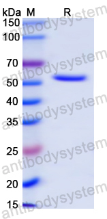 Recombinant Mouse TREH Protein, N-His