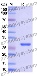 Recombinant Mouse LRP5 Protein, N-His