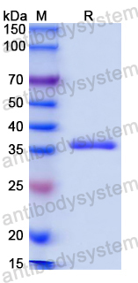 Recombinant Mouse SCEL Protein, N-GST & C-His