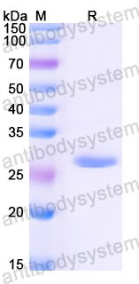 Recombinant Mouse H6PD Protein, N-His