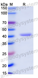 Recombinant Mouse ADA/Adenosine deaminase Protein, N-His