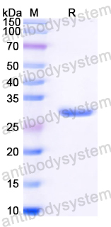 Recombinant Mouse CA1/Carbonic anhydrase 1 Protein, N-His