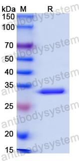 Recombinant Mouse C3/Complement C3 Protein, N-His