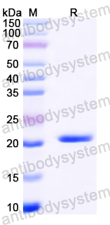 Recombinant Mouse C5/Complement C5 Protein, N-His-SUMO