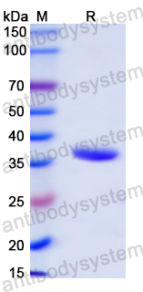 Recombinant Mouse GAST/Gastrin Protein, N-GST & C-His