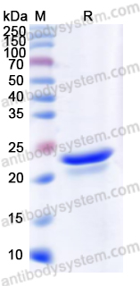 Recombinant Mouse APOE Protein, N-His
