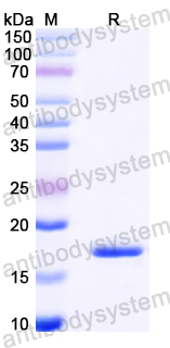 Recombinant Mouse C1QA Protein, N-His