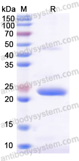 Recombinant Mouse RBP4 Protein, N-His