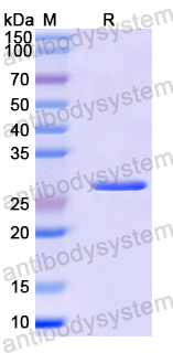 Recombinant Mouse AHSG Protein, N-His