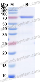 Recombinant Mouse CD71/TFRC Protein, N-His