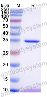 Recombinant Mouse MT2A Protein, N-GST & C-His