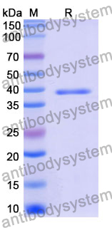 Recombinant Mouse CSTB Protein, N-GST & C-His