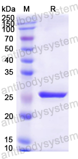 Recombinant Mouse CD74 Protein, N-His