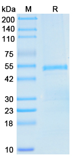 Recombinant Mouse ALDH2 Protein, N-His