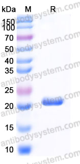 Recombinant Mouse IL6/Interleukin-6 Protein, Tag free