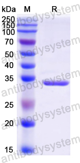 Recombinant Mouse CRH Protein, N-GST & C-His
