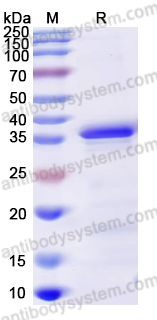 Recombinant Mouse TH Protein, N-His