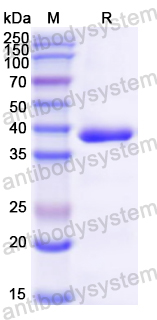 Recombinant Mouse DBI Protein, N-GST & C-His