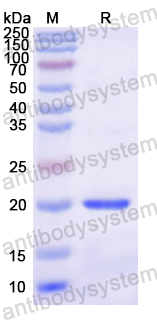 Recombinant Mouse GPX1 Protein, N-His
