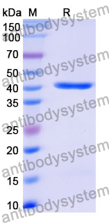 Recombinant Mouse PROS1 Protein, N-His