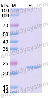 Recombinant Mouse THBS1 Protein, N-His