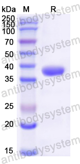 Recombinant Mouse MGP Protein, N-GST & C-His