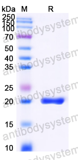 Recombinant Mouse MGP Protein, N-His