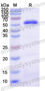 Recombinant Mouse Cyp21 Protein, N-His