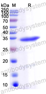 Recombinant Mouse CD126/IL6R/IL-6RA Protein, N-His