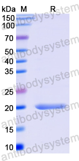 Recombinant Mouse GLI2 Protein, N-His