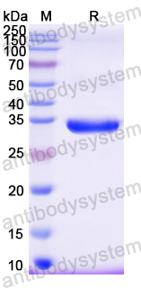 Recombinant Mouse CD20/MS4A1 Protein, N-GST & C-His