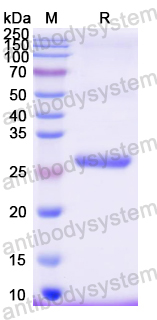 Recombinant Mouse GZMA/Granzyme A Protein, N-His