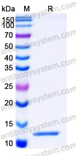 Recombinant Mouse CCL2/MCP-1 Protein, Tag free