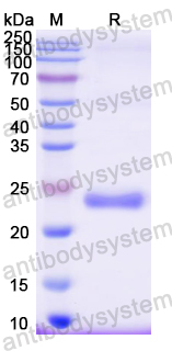 Recombinant Mouse OSM/Oncostatin-M Protein, N-His