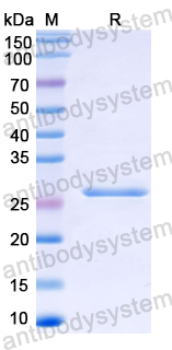 Recombinant Mouse HGF Protein, N-His