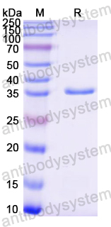 Recombinant Mouse FOSL1 Protein, N-GST & C-His